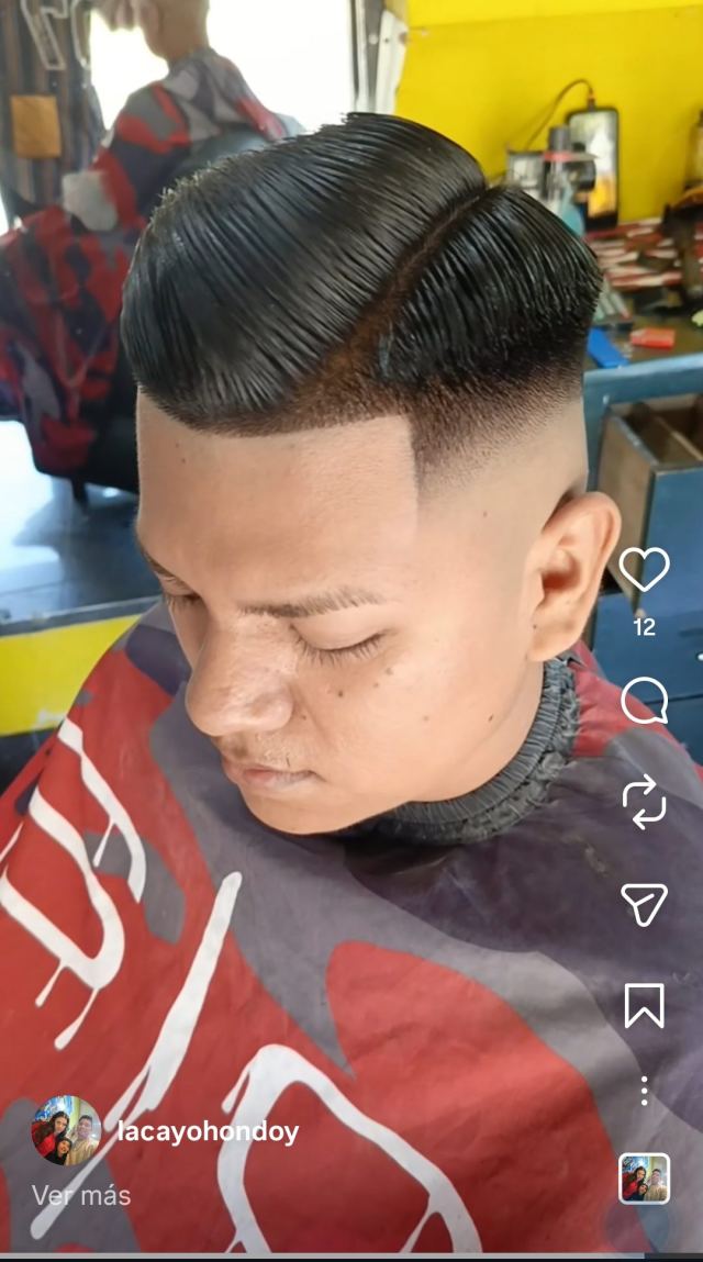 frontal